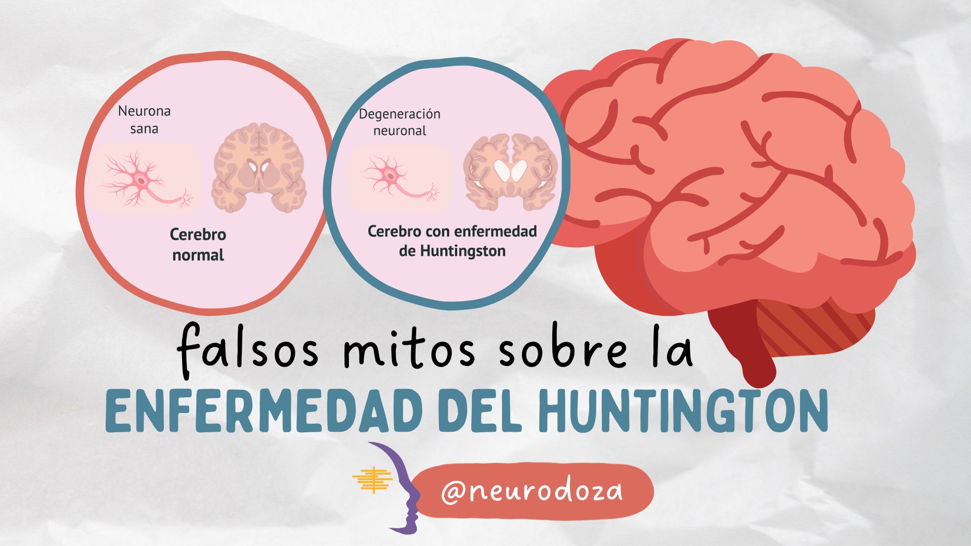 Desmitificando La Enfermedad De Huntington Neurodoza