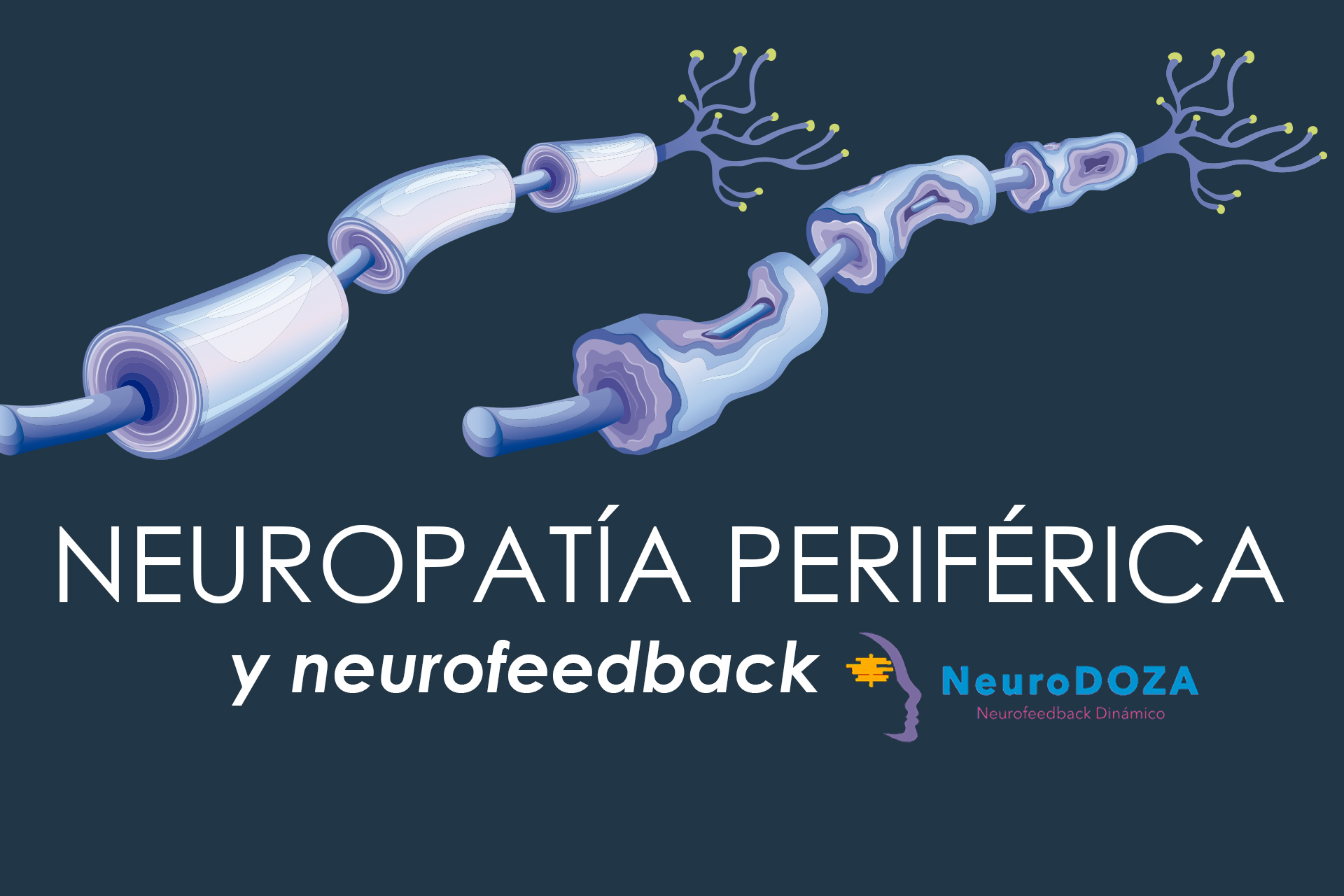 ¿Qué Es La Neuropatía Periférica? - NeuroDoza